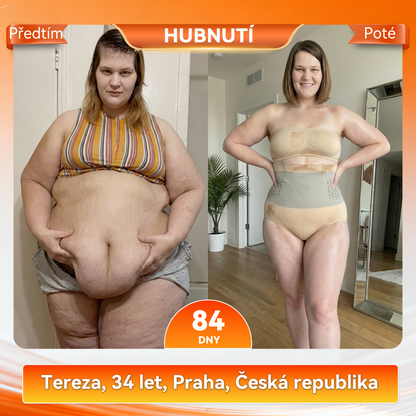 Záruka originality produktu|👩‍⚕️𝑷𝑨𝑈𝑅𝑨𝑱𝑼® MORINGA A BERBERIN 4v1 MIROČÁSTICOVÉ TVARAJÍCÍ A TUK SPALUJÍCÍ KRÁTKÉ KALHOTY 🐽