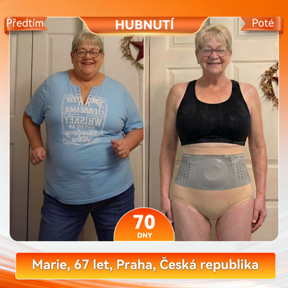 Záruka originality produktu|👩‍⚕️𝑷𝑨𝑈𝑅𝑨𝑱𝑼® MORINGA A BERBERIN 4v1 MIROČÁSTICOVÉ TVARAJÍCÍ A TUK SPALUJÍCÍ KRÁTKÉ KALHOTY 🐽