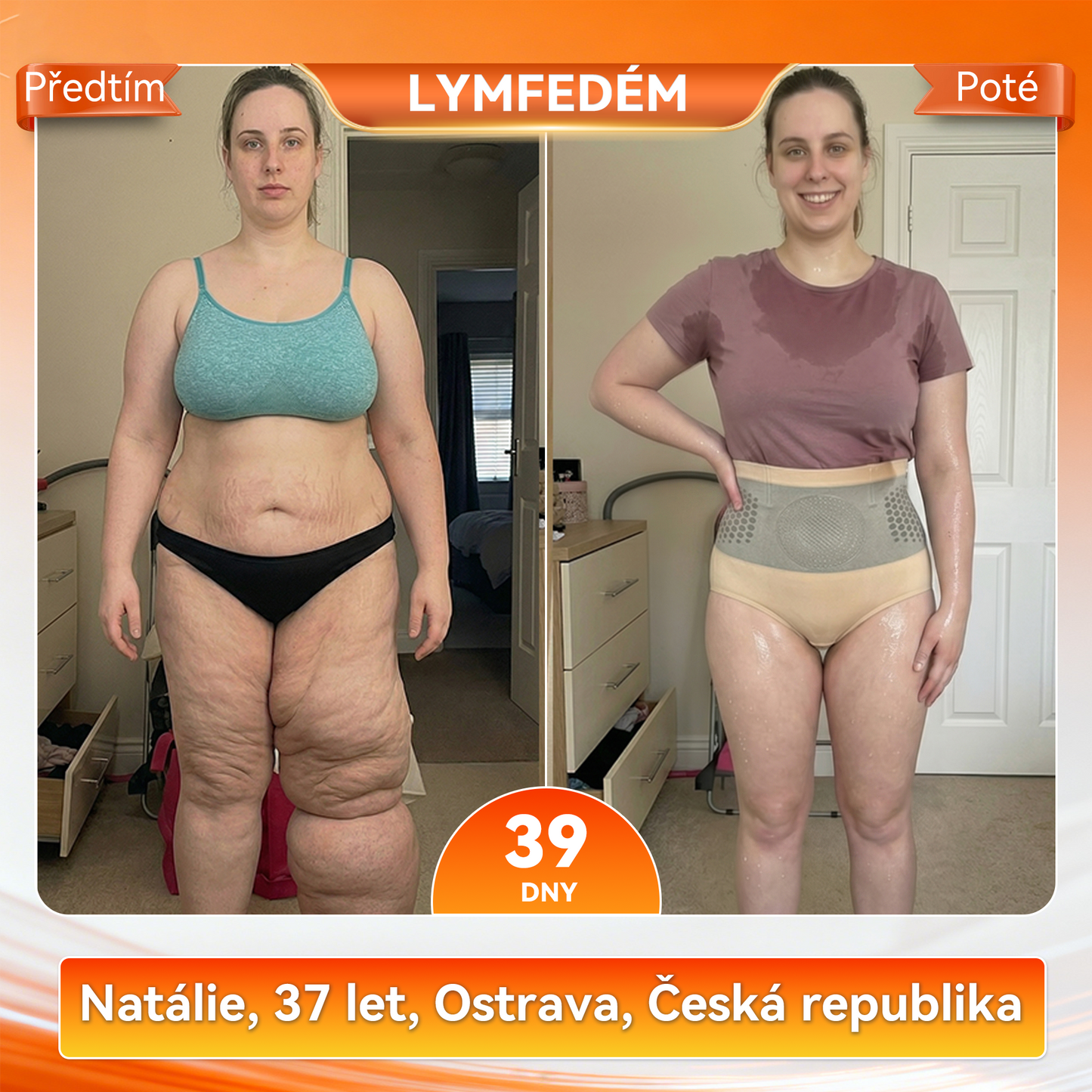 Záruka originality produktu|👩‍⚕️𝑷𝑨𝑈𝑅𝑨𝑱𝑼® MORINGA A BERBERIN 4v1 MIROČÁSTICOVÉ TVARAJÍCÍ A TUK SPALUJÍCÍ KRÁTKÉ KALHOTY 🐽