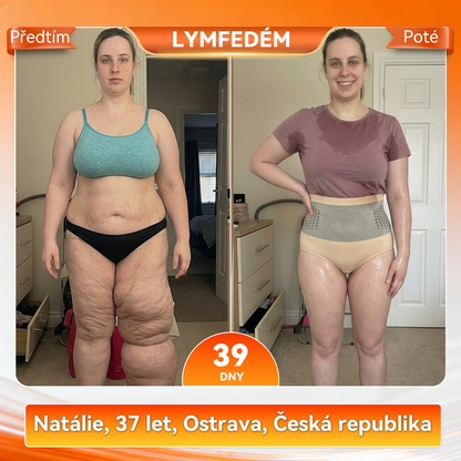 Záruka originality produktu|👩‍⚕️𝑷𝑨𝑈𝑅𝑨𝑱𝑼® MORINGA A BERBERIN 4v1 MIROČÁSTICOVÉ TVARAJÍCÍ A TUK SPALUJÍCÍ KRÁTKÉ KALHOTY 🐽