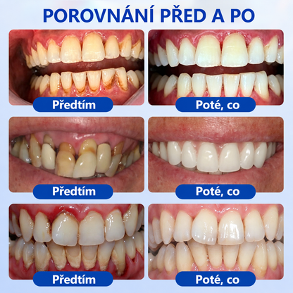 𝐄𝐯𝐨𝐥𝐯𝐢𝐨𝐧® 𝐆𝐮𝐦𝐑𝐞𝐯𝐢𝐯𝐞 𝐆𝐞𝐥 𝐩𝐫𝐨 𝐫𝐞𝐠𝐞𝐧𝐞𝐫𝐚𝐜𝐢 𝐩𝐚𝐫𝐨𝐝𝐨𝐧𝐭𝐮🐮