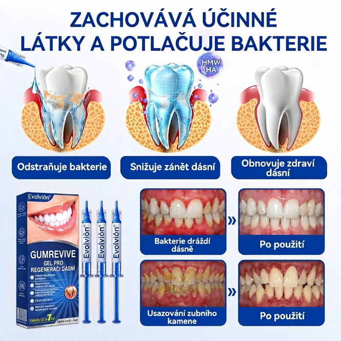 𝐄𝐯𝐨𝐥𝐯𝐢𝐨𝐧® 𝐆𝐮𝐦𝐑𝐞𝐯𝐢𝐯𝐞 𝐆𝐞𝐥 𝐩𝐫𝐨 𝐫𝐞𝐠𝐞𝐧𝐞𝐫𝐚𝐜𝐢 𝐩𝐚𝐫𝐨𝐝𝐨𝐧𝐭𝐮🍃