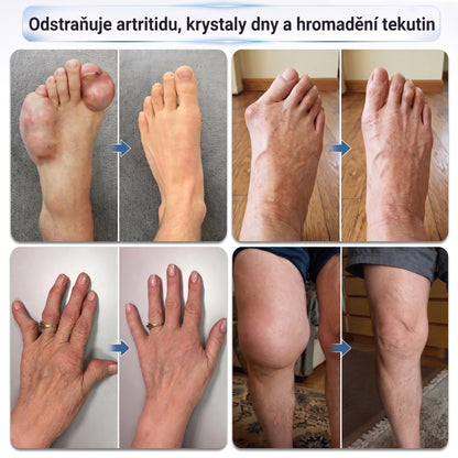 OFICIÁLNÍ OBCHOD | IFMAGIC® 0,05 mm Mikroneedle Rychle Působící Roll-On pro Úlevu Kloubů a Kostí🎃