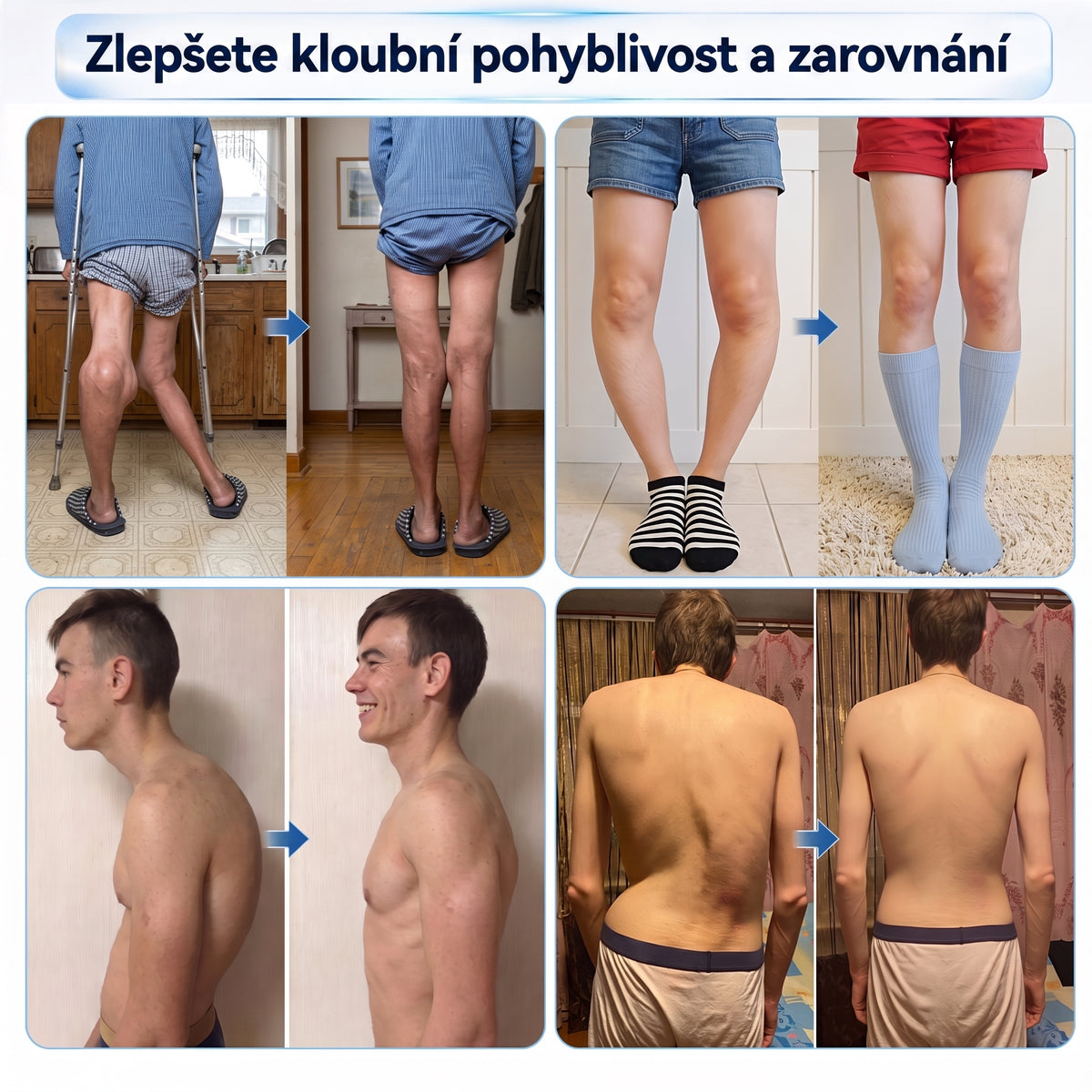 OFICIÁLNÍ OBCHOD | IFMAGIC® 0,05 mm Mikroneedle Rychle Působící Roll-On pro Úlevu Kloubů a Kostí🎃