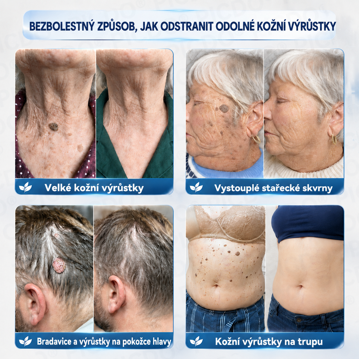 𝐏𝐢𝐜𝐝𝐨® 𝐈𝐧𝐭𝐞𝐧𝐳𝐢𝐯𝐧í 𝟕𝐝𝐞𝐧𝐧í 𝐤𝐫é𝐦 𝐤 𝐫𝐞𝐝𝐮𝐤𝐜𝐢 𝐤𝐨ž𝐧í𝐜𝐡 𝐯ý𝐫ů𝐬𝐭𝐤ů 𝐚 𝐬𝐭𝐚ř𝐞𝐜𝐤ý𝐜𝐡 𝐬𝐤𝐯𝐫𝐧 – Š𝐞𝐭𝐫𝐧á 𝐩éč𝐞 𝐛𝐞𝐳 𝐣𝐢𝐳𝐞𝐯 🍊