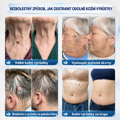 𝐏𝐢𝐜𝐝𝐨® 𝐈𝐧𝐭𝐞𝐧𝐳𝐢𝐯𝐧í 𝟕𝐝𝐞𝐧𝐧í 𝐤𝐫é𝐦 𝐤 𝐫𝐞𝐝𝐮𝐤𝐜𝐢 𝐤𝐨ž𝐧í𝐜𝐡 𝐯ý𝐫ů𝐬𝐭𝐤ů 𝐚 𝐬𝐭𝐚ř𝐞𝐜𝐤ý𝐜𝐡 𝐬𝐤𝐯𝐫𝐧 – Š𝐞𝐭𝐫𝐧á 𝐩éč𝐞 𝐛𝐞𝐳 𝐣𝐢𝐳𝐞𝐯 🍊