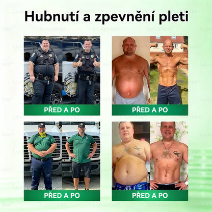 Oficiální obchod  |𝗟𝘂𝘅𝗮𝗿𝗶𝘀𝗲® MORINGA X BERBERIN  10-IN-1 Pokročilý Nano Mikrojehly Náplast(Jedna náplast denně, viditelné změny již za 7 dní) ✅ Pomáhá při obezitě, cukrovce, spánkové apnoe, problémech s klouby a dalších potížích 🌹