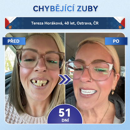 𝐺𝒍𝒊𝗆𝗆𝑒𝑟𝗹𝘆®🦷 𝑇𝑖𝑑𝑒𝑔𝑙𝑢𝑠𝑖𝑏 𝑀𝑖𝑐𝑟𝑜𝑛𝑒𝑒𝑑𝑙𝑒 𝑃𝑎𝑡𝑐ℎ 𝑛𝑎 𝑜𝑝𝑟𝑎𝑣𝑢 𝑧𝑢𝑏ů 𝑎 𝑑á𝑠𝑛í | 𝑃𝑜𝑘𝑟𝑜č𝑖𝑙é 𝑛á𝑝𝑙𝑎𝑠𝑡𝑖 𝑝𝑟𝑜 𝑎𝑘𝑡𝑖𝑣𝑎𝑐𝑖 𝑘𝑚𝑒𝑛𝑜𝑣ý𝑐ℎ 𝑏𝑢𝑛ě𝑘 𝑧𝑢𝑏ů 👩‍⚕️(𝑶𝒃𝒏𝒐𝒗𝒂 𝒛𝒖𝒃𝒏í 𝒔𝒌𝒍𝒐𝒗𝒊𝒏𝒚 𝒂 𝒅𝒆𝒏𝒕𝒊𝒏𝒖 • 𝑷𝒐𝒔í𝒍𝒆𝒏í 𝒅á𝒔𝒏í • 𝑶𝒅𝒔𝒕𝒓𝒂𝒏ě𝒏í 𝒛𝒖𝒃𝒏í𝒉𝒐 𝒌𝒂𝒎𝒆𝒏𝒆 𝒂 𝒛á𝒑𝒂𝒄𝒉𝒖 • 𝒁𝒂𝒔𝒕𝒂𝒗𝒆𝒏í 𝒄𝒊𝒕𝒍𝒊𝒗𝒐𝒔𝒕𝒊 𝒛𝒖𝒃ů)🔥