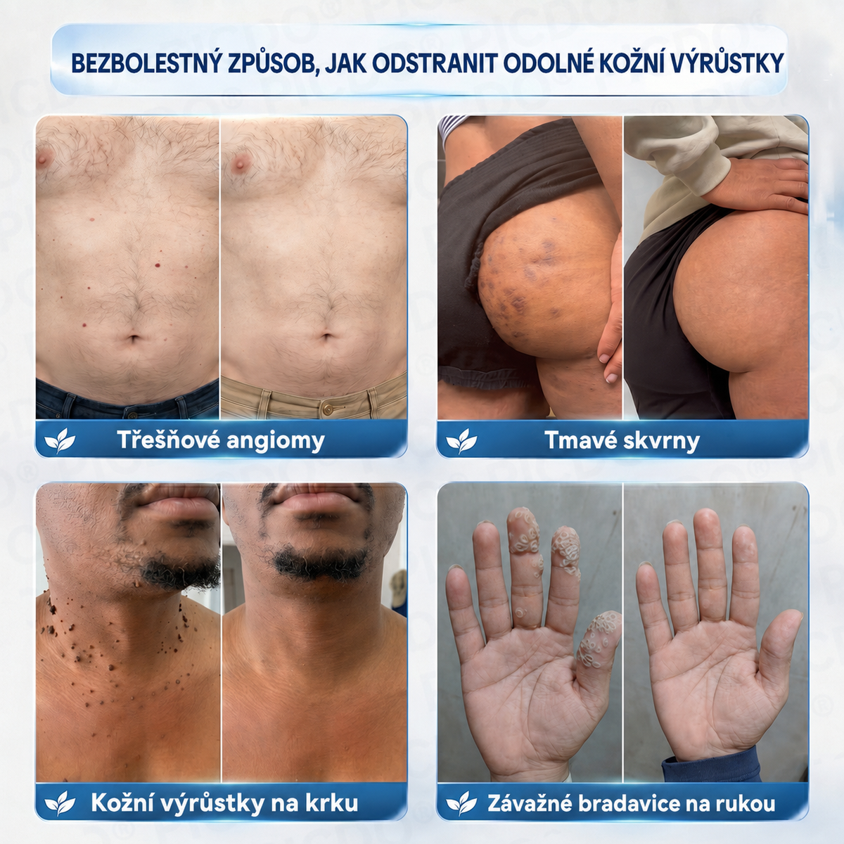 𝐏𝐢𝐜𝐝𝐨® 𝐈𝐧𝐭𝐞𝐧𝐳𝐢𝐯𝐧í 𝟕𝐝𝐞𝐧𝐧í 𝐤𝐫é𝐦 𝐤 𝐫𝐞𝐝𝐮𝐤𝐜𝐢 𝐤𝐨ž𝐧í𝐜𝐡 𝐯ý𝐫ů𝐬𝐭𝐤ů 𝐚 𝐬𝐭𝐚ř𝐞𝐜𝐤ý𝐜𝐡 𝐬𝐤𝐯𝐫𝐧 – Š𝐞𝐭𝐫𝐧á 𝐩éč𝐞 𝐛𝐞𝐳 𝐣𝐢𝐳𝐞𝐯 🍊