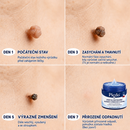 𝐏𝐢𝐜𝐝𝐨® 𝐈𝐧𝐭𝐞𝐧𝐳𝐢𝐯𝐧í 𝟕𝐝𝐞𝐧𝐧í 𝐤𝐫é𝐦 𝐤 𝐫𝐞𝐝𝐮𝐤𝐜𝐢 𝐤𝐨ž𝐧í𝐜𝐡 𝐯ý𝐫ů𝐬𝐭𝐤ů 𝐚 𝐬𝐭𝐚ř𝐞𝐜𝐤ý𝐜𝐡 𝐬𝐤𝐯𝐫𝐧 – Š𝐞𝐭𝐫𝐧á 𝐩éč𝐞 𝐛𝐞𝐳 𝐣𝐢𝐳𝐞𝐯 🍊