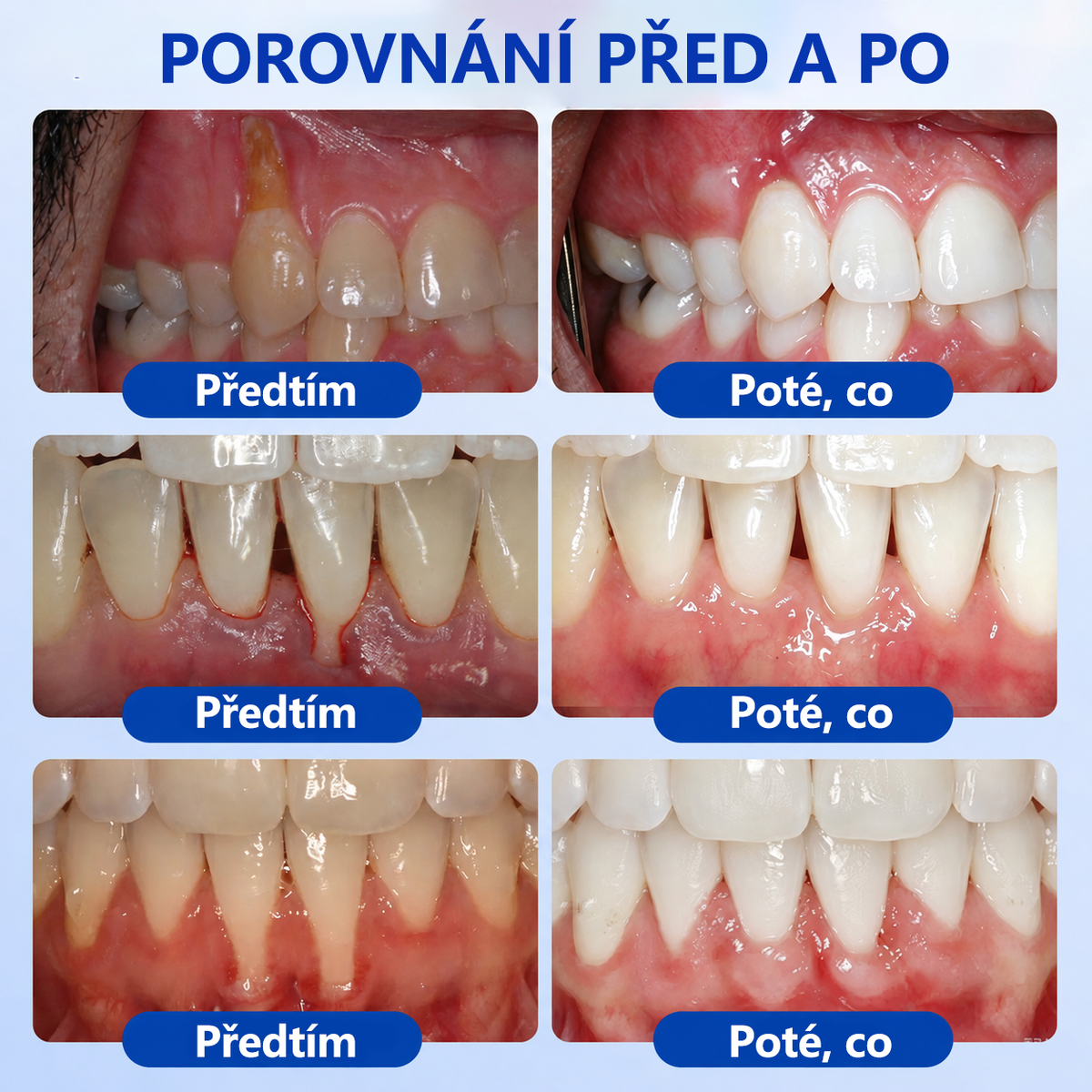 𝐄𝐯𝐨𝐥𝐯𝐢𝐨𝐧® 𝐆𝐮𝐦𝐑𝐞𝐯𝐢𝐯𝐞 𝐆𝐞𝐥 𝐩𝐫𝐨 𝐫𝐞𝐠𝐞𝐧𝐞𝐫𝐚𝐜𝐢 𝐩𝐚𝐫𝐨𝐝𝐨𝐧𝐭𝐮🐮