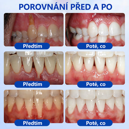 𝐄𝐯𝐨𝐥𝐯𝐢𝐨𝐧® 𝐆𝐮𝐦𝐑𝐞𝐯𝐢𝐯𝐞 𝐆𝐞𝐥 𝐩𝐫𝐨 𝐫𝐞𝐠𝐞𝐧𝐞𝐫𝐚𝐜𝐢 𝐩𝐚𝐫𝐨𝐝𝐨𝐧𝐭𝐮🐮