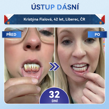 𝐺𝒍𝒊𝗆𝗆𝑒𝑟𝗹𝘆®🦷 𝑇𝑖𝑑𝑒𝑔𝑙𝑢𝑠𝑖𝑏 𝑀𝑖𝑐𝑟𝑜𝑛𝑒𝑒𝑑𝑙𝑒 𝑃𝑎𝑡𝑐ℎ 𝑛𝑎 𝑜𝑝𝑟𝑎𝑣𝑢 𝑧𝑢𝑏ů 𝑎 𝑑á𝑠𝑛í | 𝑃𝑜𝑘𝑟𝑜č𝑖𝑙é 𝑛á𝑝𝑙𝑎𝑠𝑡𝑖 𝑝𝑟𝑜 𝑎𝑘𝑡𝑖𝑣𝑎𝑐𝑖 𝑘𝑚𝑒𝑛𝑜𝑣ý𝑐ℎ 𝑏𝑢𝑛ě𝑘 𝑧𝑢𝑏ů 👩‍⚕️(𝑶𝒃𝒏𝒐𝒗𝒂 𝒛𝒖𝒃𝒏í 𝒔𝒌𝒍𝒐𝒗𝒊𝒏𝒚 𝒂 𝒅𝒆𝒏𝒕𝒊𝒏𝒖 • 𝑷𝒐𝒔í𝒍𝒆𝒏í 𝒅á𝒔𝒏í • 𝑶𝒅𝒔𝒕𝒓𝒂𝒏ě𝒏í 𝒛𝒖𝒃𝒏í𝒉𝒐 𝒌𝒂𝒎𝒆𝒏𝒆 𝒂 𝒛á𝒑𝒂𝒄𝒉𝒖 • 𝒁𝒂𝒔𝒕𝒂𝒗𝒆𝒏í 𝒄𝒊𝒕𝒍𝒊𝒗𝒐𝒔𝒕𝒊 𝒛𝒖𝒃ů)🔥